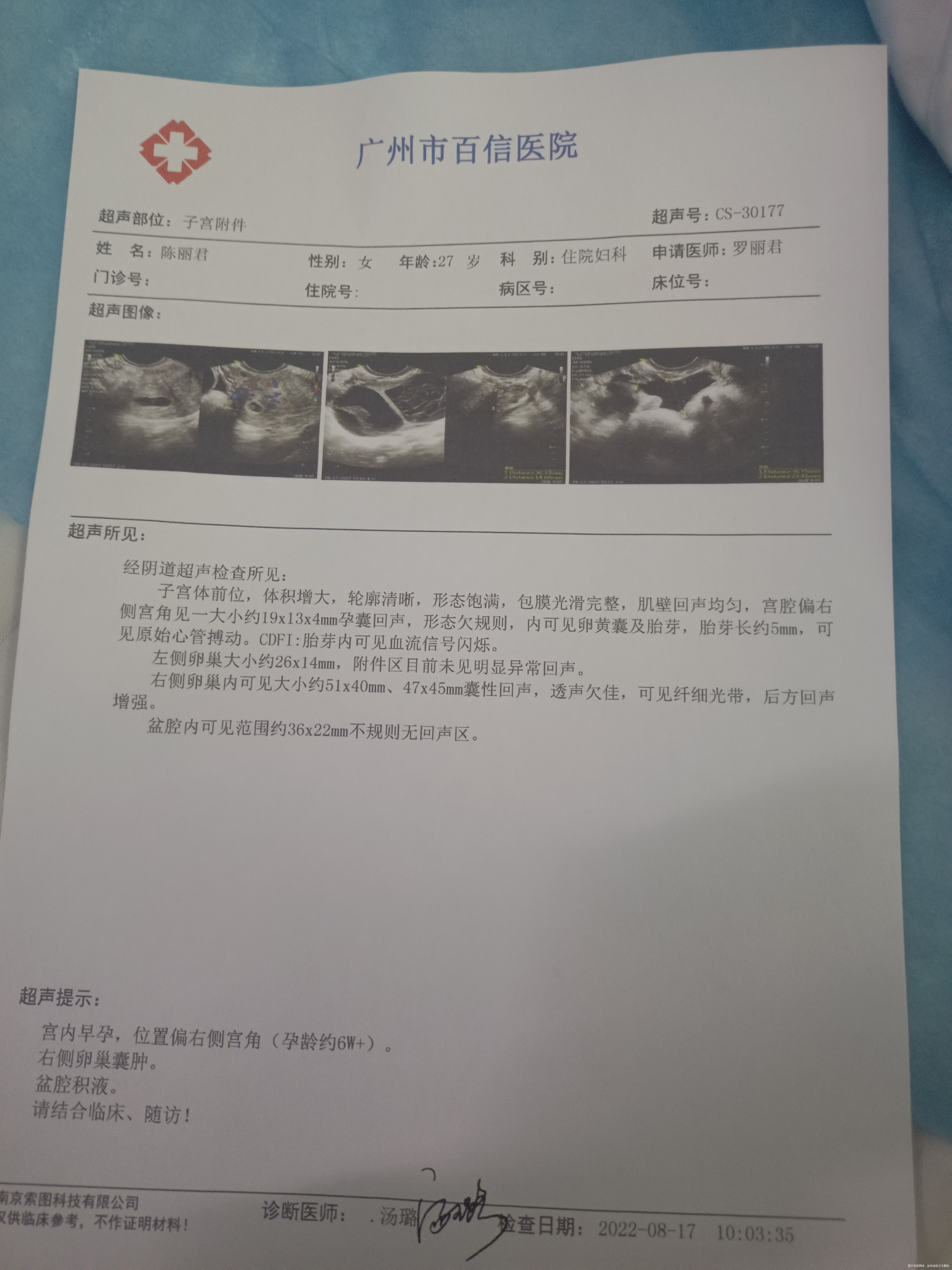 我还有等回正的机会吗