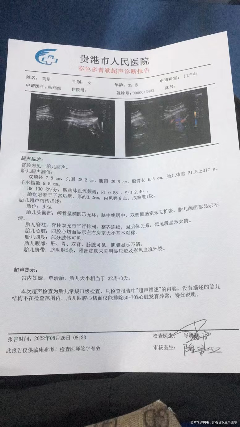 孕33周+4了彩超只有32+3这算小很多吗急