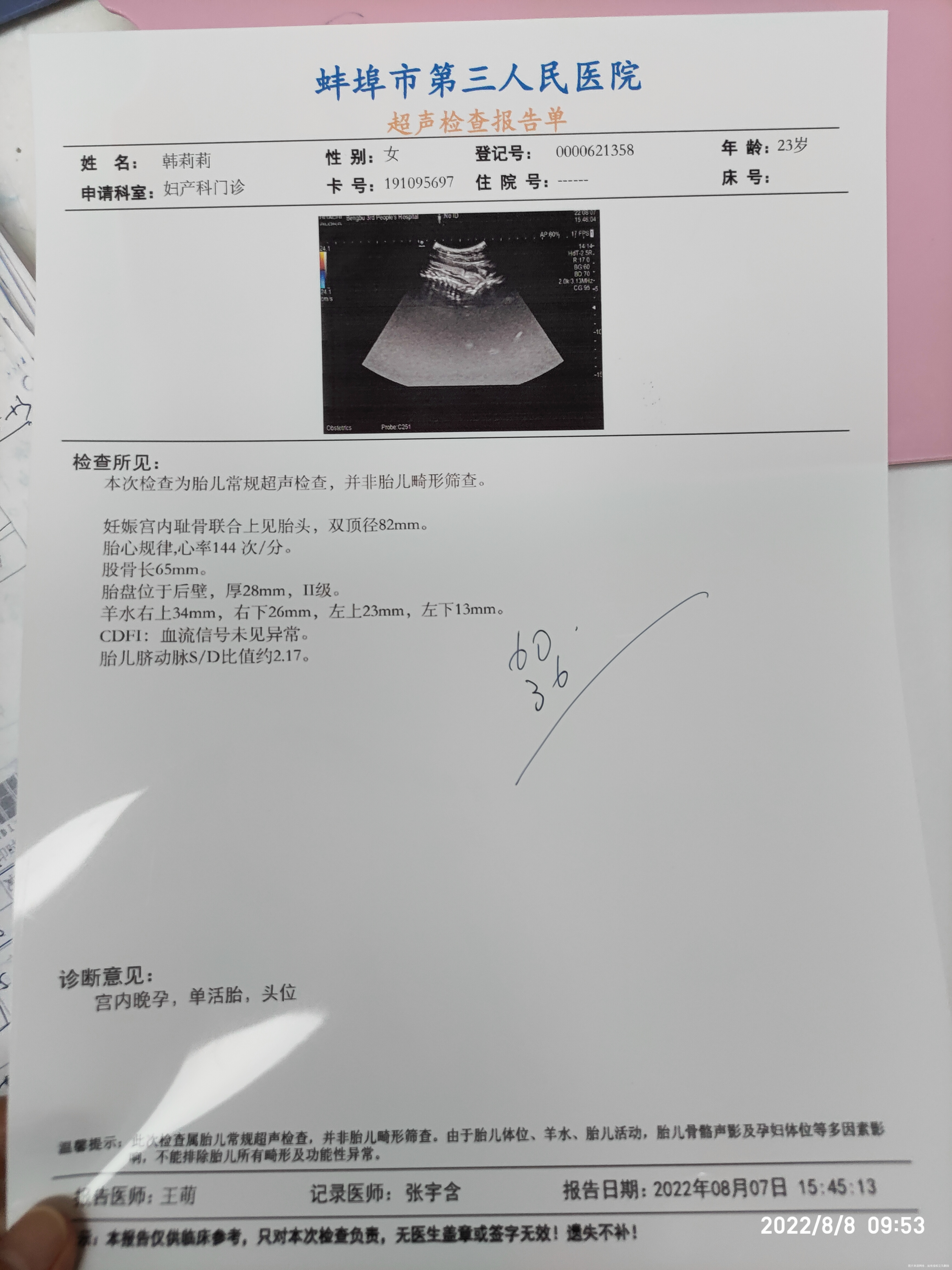 各位医生好请问孕33周羊水是否少