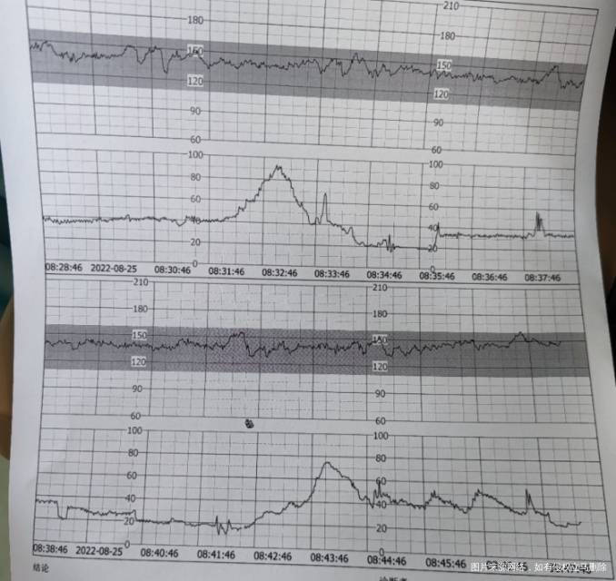 你好想问下监护怎么样还得排队太麻烦了