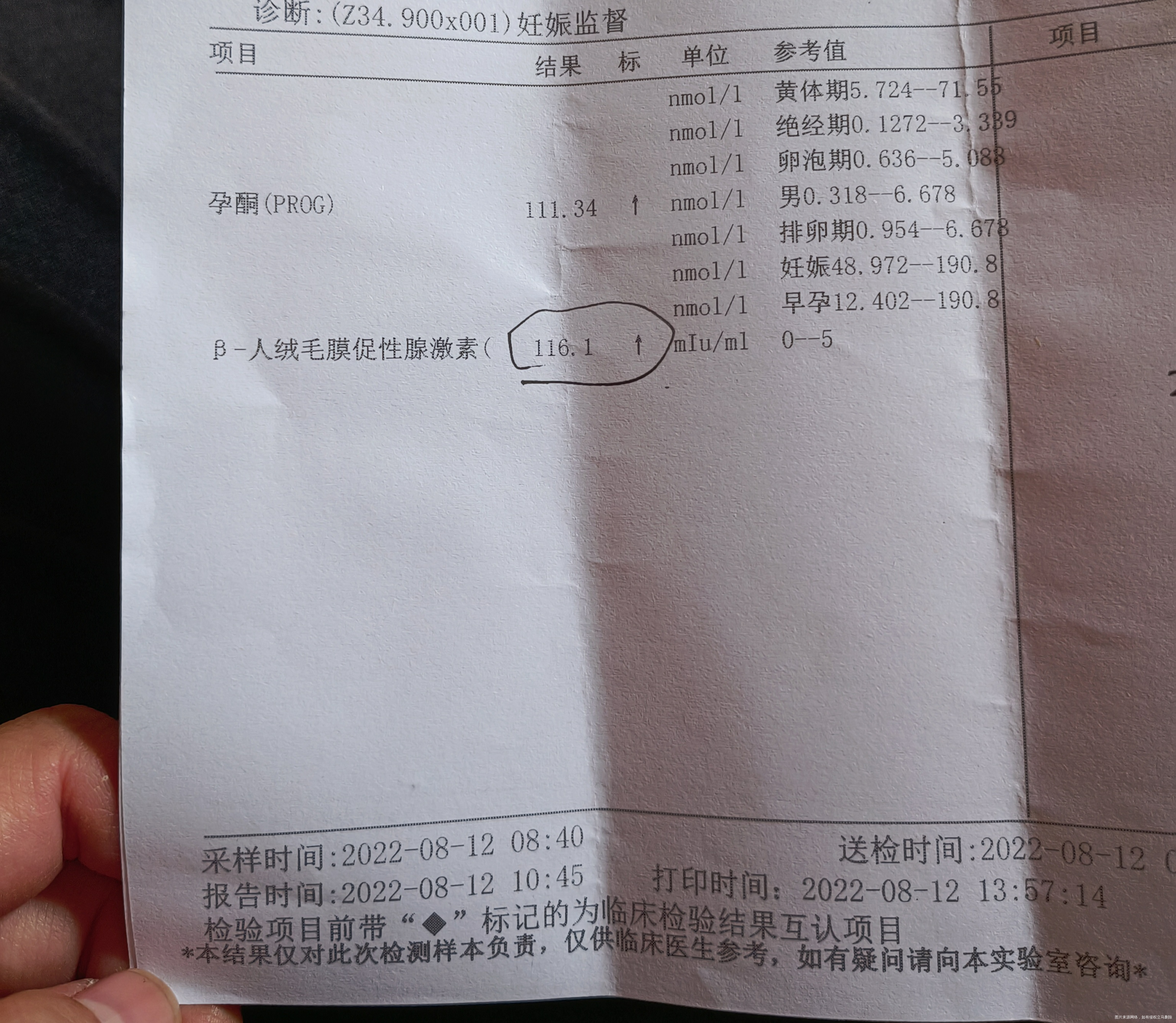 末次月经7月8日月经周期31天有时候会推迟今