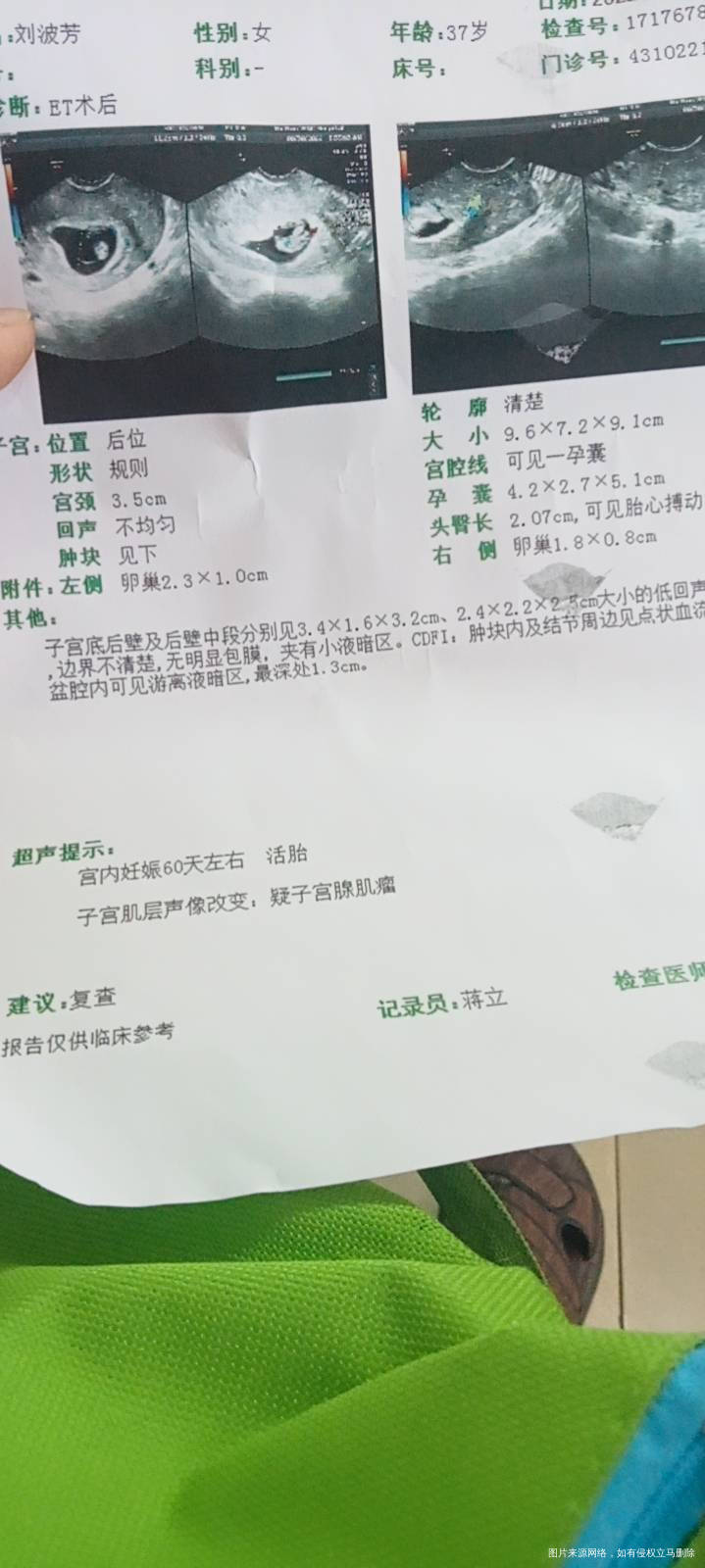 B超正常吗子宫腺肌瘤会不会有影响需要怎么控制