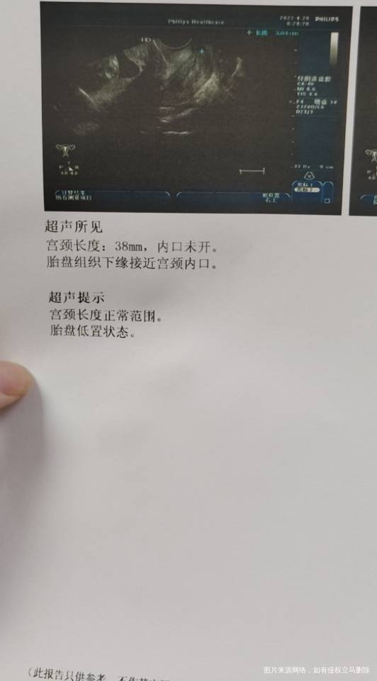 孕16周了今天检查胎盘低置胎盘请问我要注意什