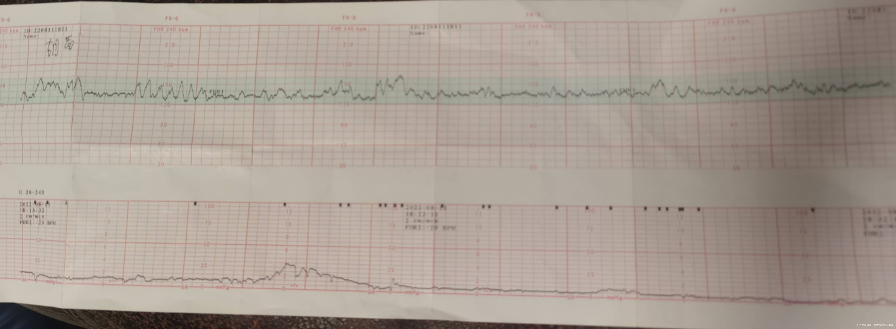 快帮我看看这个胎心监护阿同一天做了3次最后一