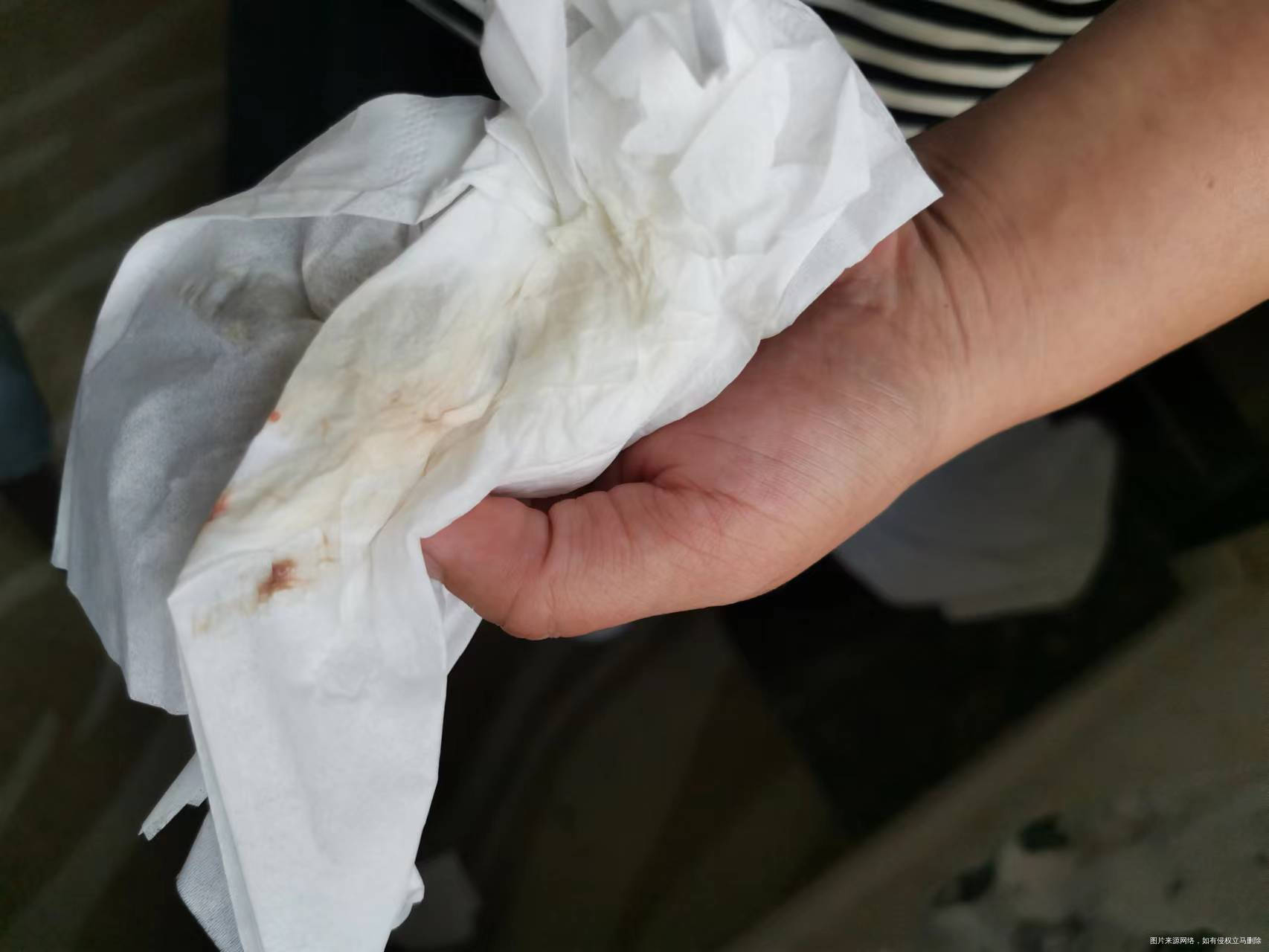 移植回来第二天早上有咖啡色分泌物这是什么事啊