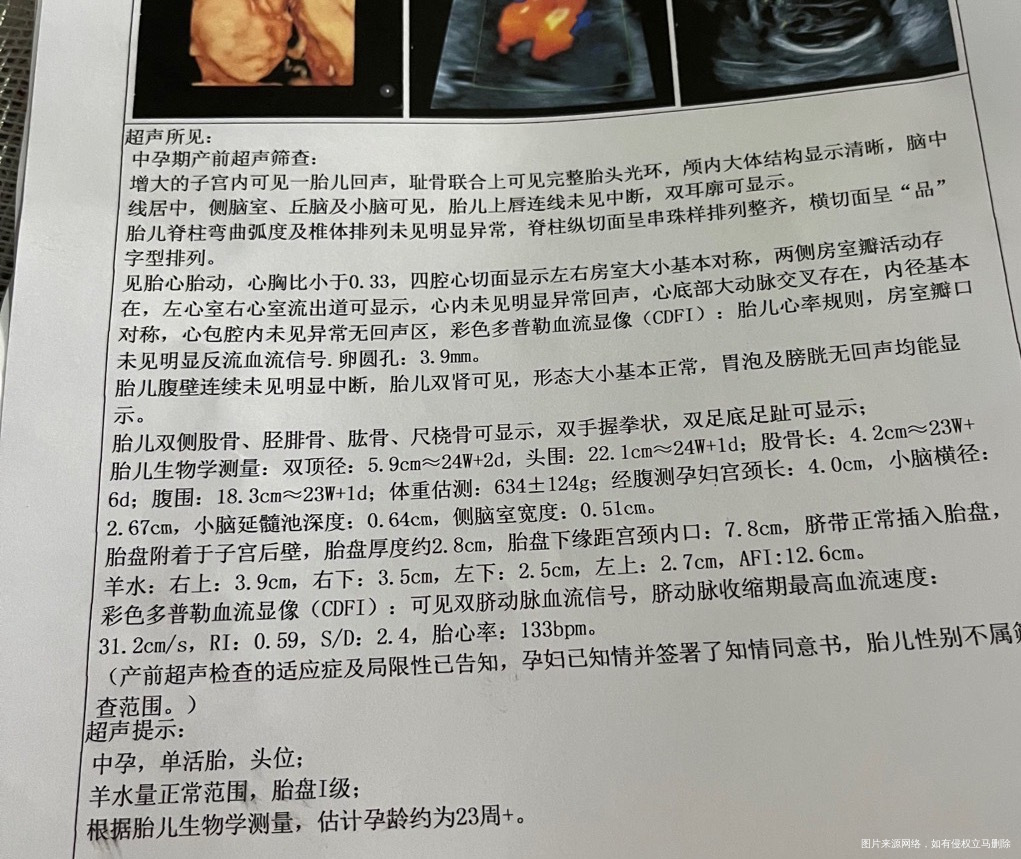 做nt的时候胎盘低这次做了四维看一下可以同房