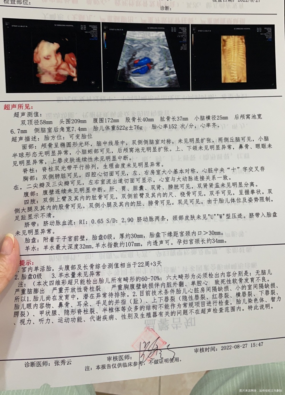末次月经312平均月经周期31天左右麻烦医生