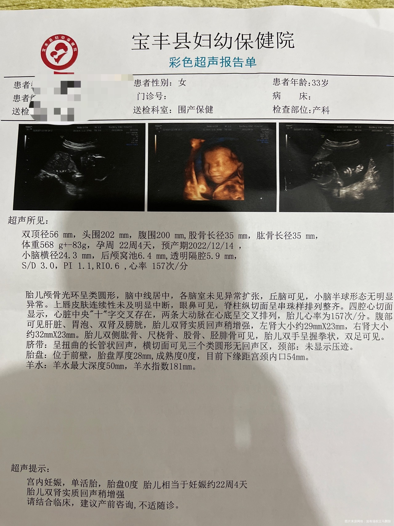 医生你好今天做了四维说是孩子右肾比左肾大且饱