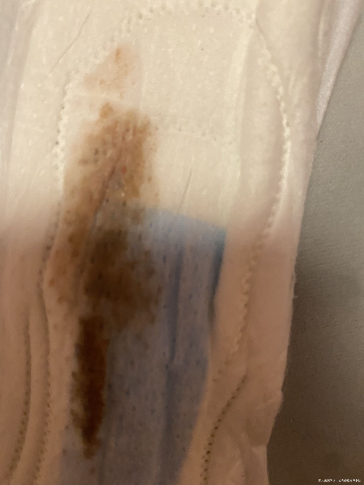 取卵后流这个情况正常吗