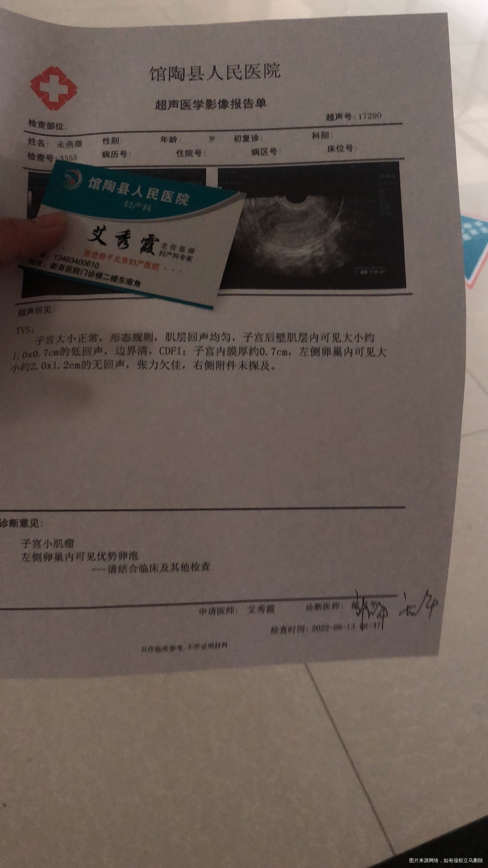 内膜07没有排卵呢卵泡20/12来月经了怎么