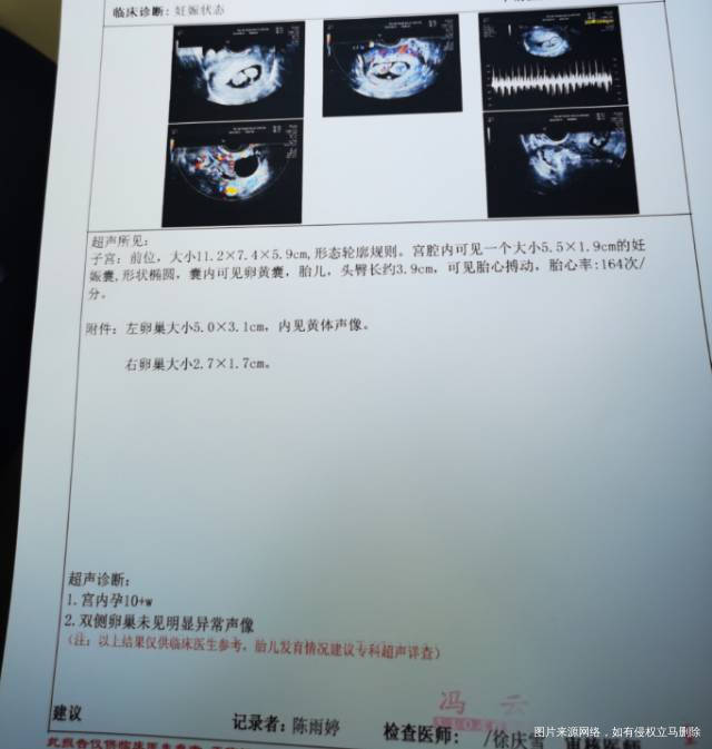 请问医生这个b超显示正常吗现在是孕75天上一