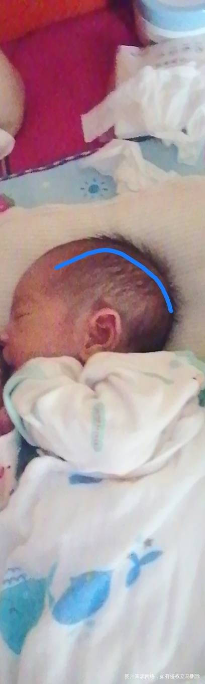 宝宝脑袋头顶和漩涡那都是软的正常吗