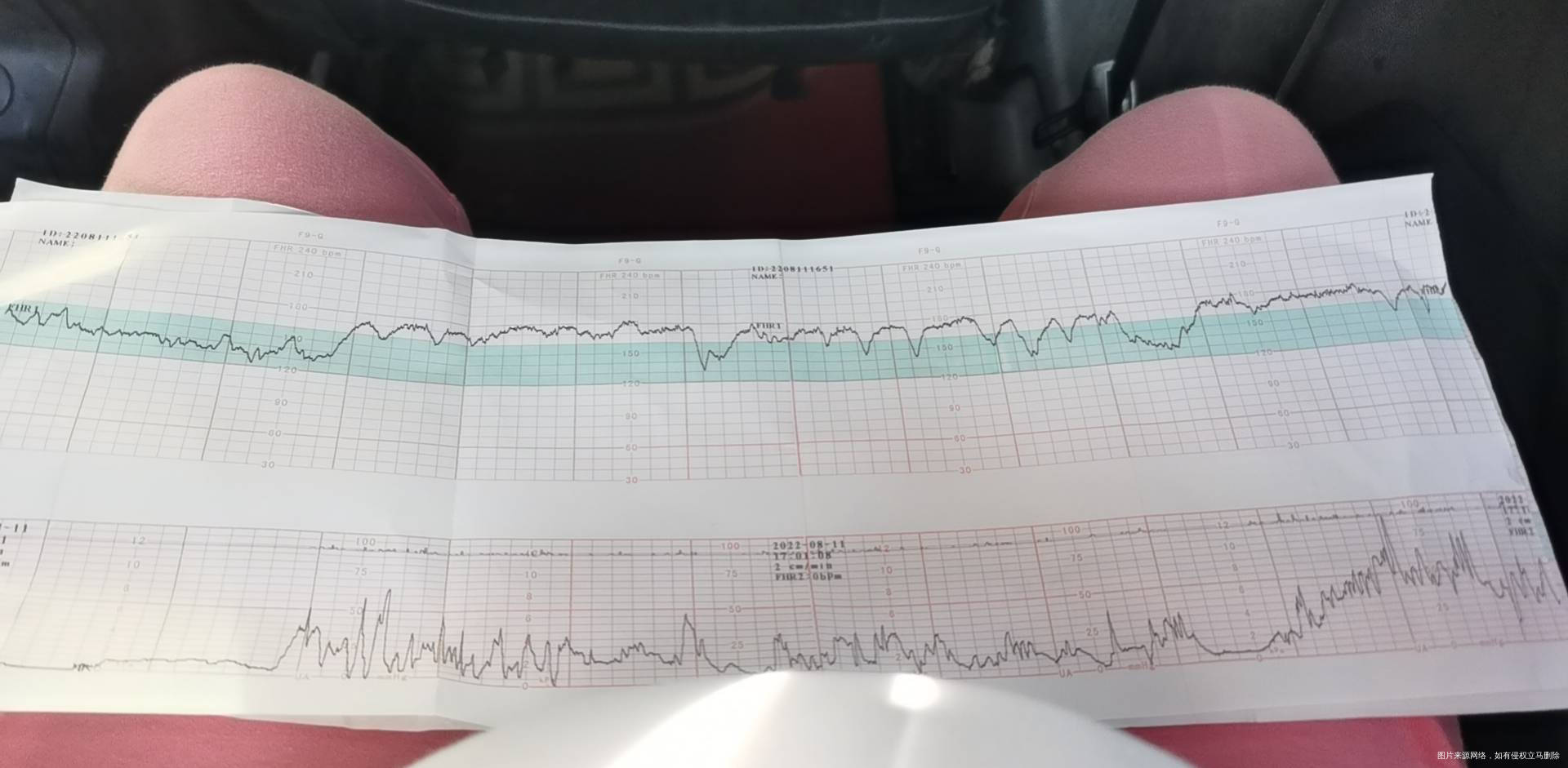 快帮我看看这个胎心监护阿同一天做了3次最后一