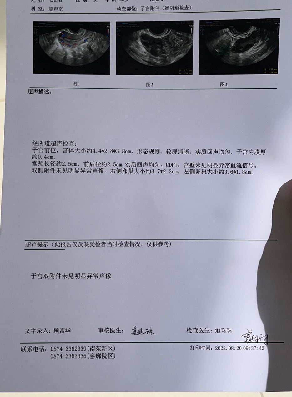 备孕两年有瘦多囊内膜不长月经不调闭经倾向