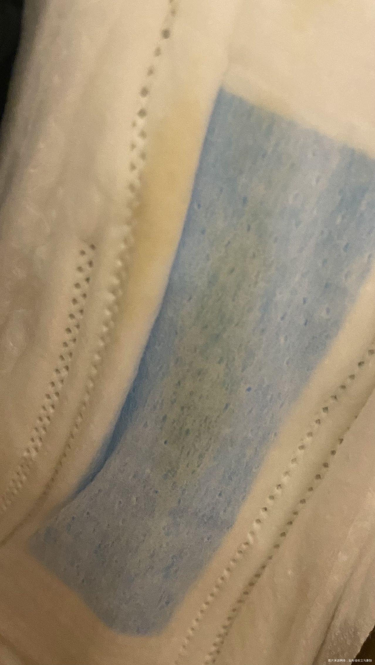 月经结束分泌物发黄正常吗没其他不适