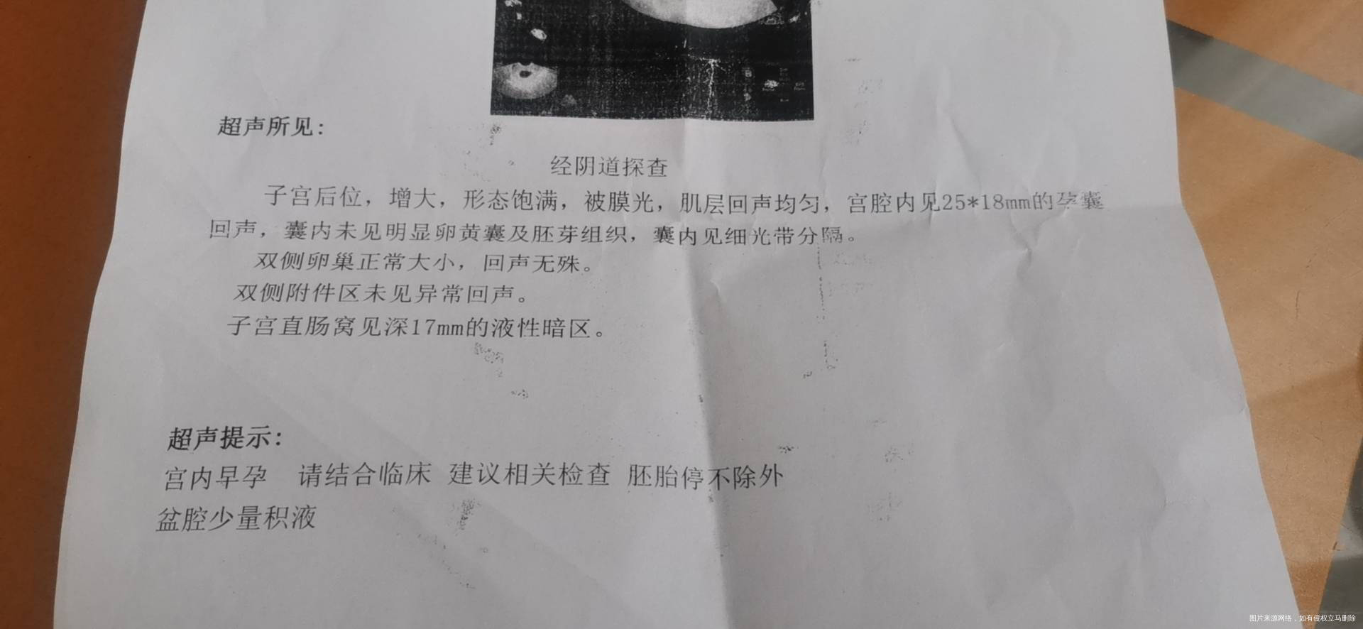 试管移植囊胚今天6周查血B超说的没有卵黄囊这