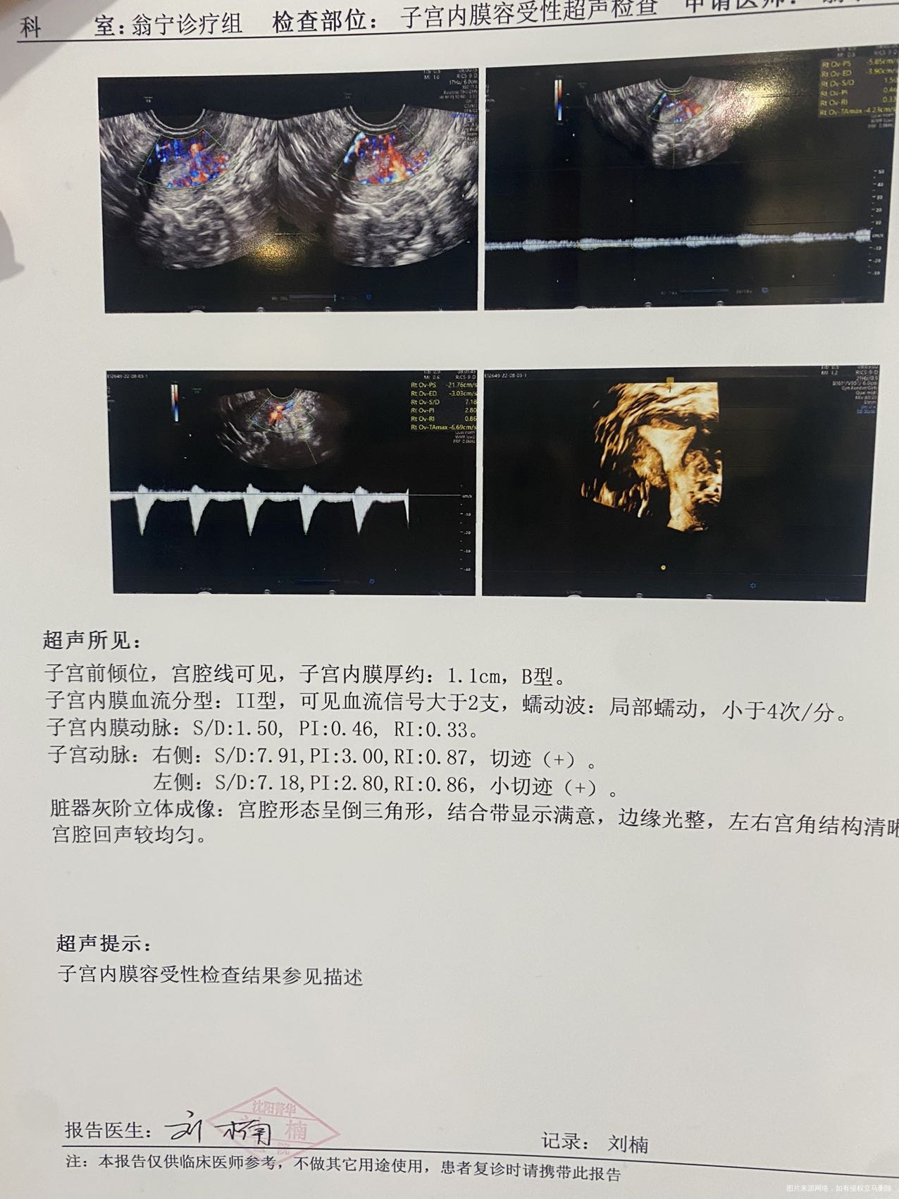 后天移植内膜容受性请问影响着床吗医生给我开了