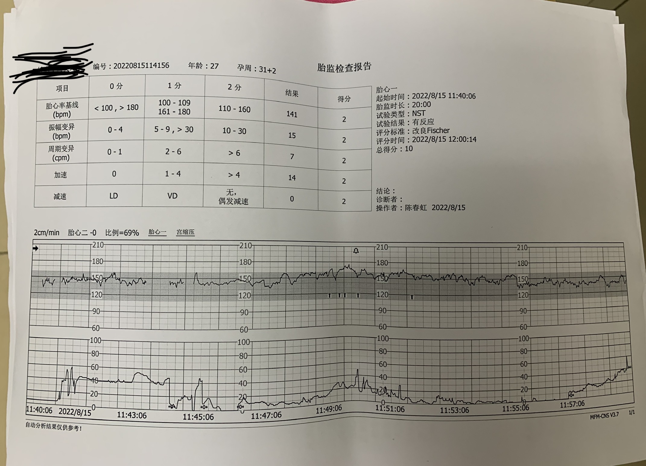 第一张孕30+做的彩超胎位不正回来就膝胸卧位