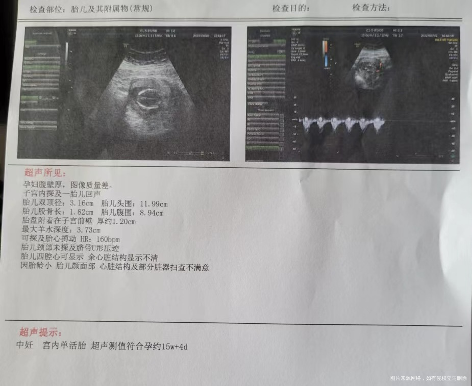 目前16➕1这个b超报告正常吗