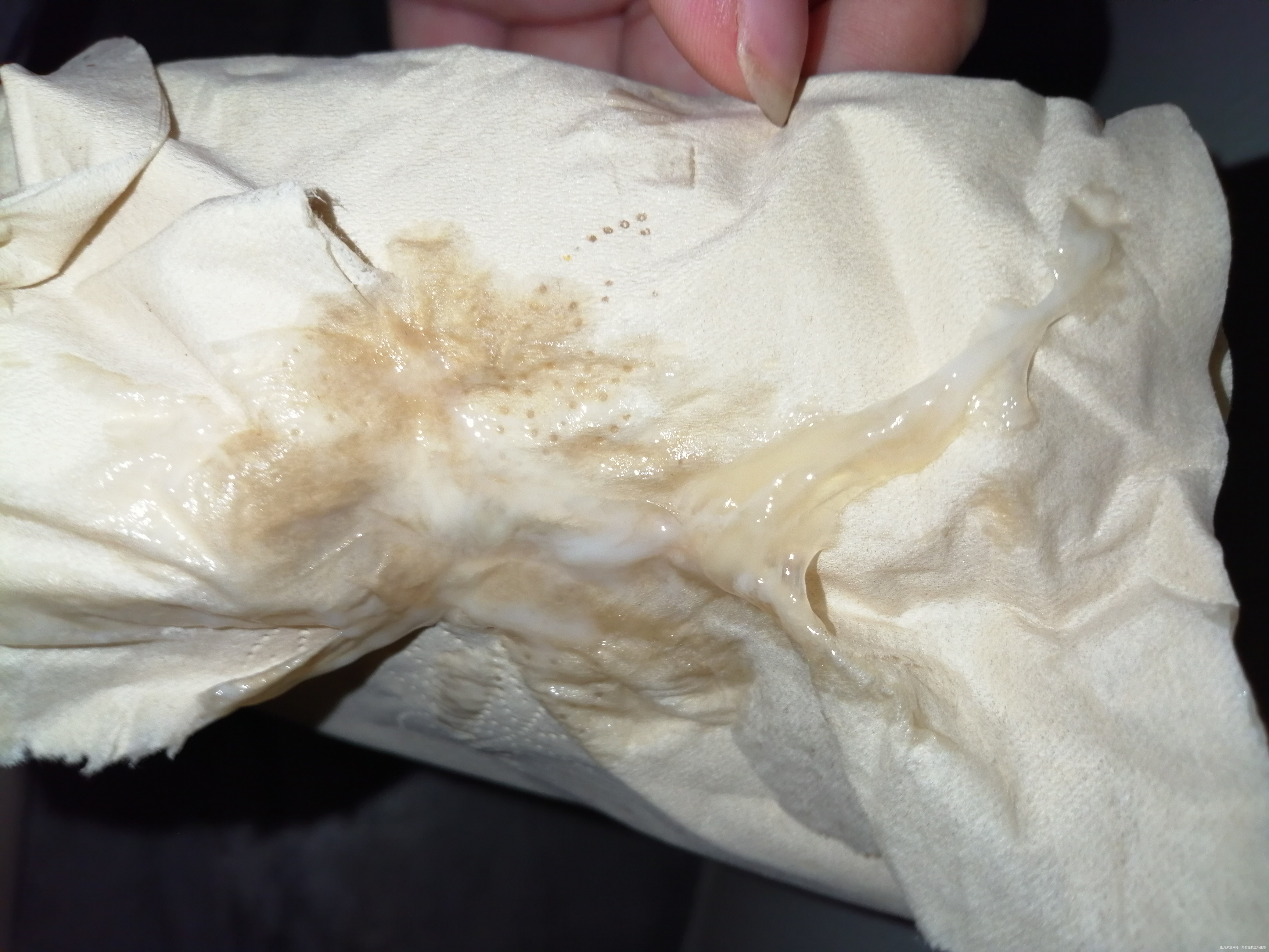 38+5周了这些分泌物是不是要发动了肚子不疼