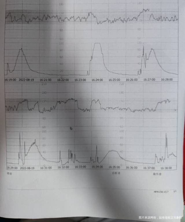 一点也没感觉说宫缩很勤正常吗孩子不缺氧吧