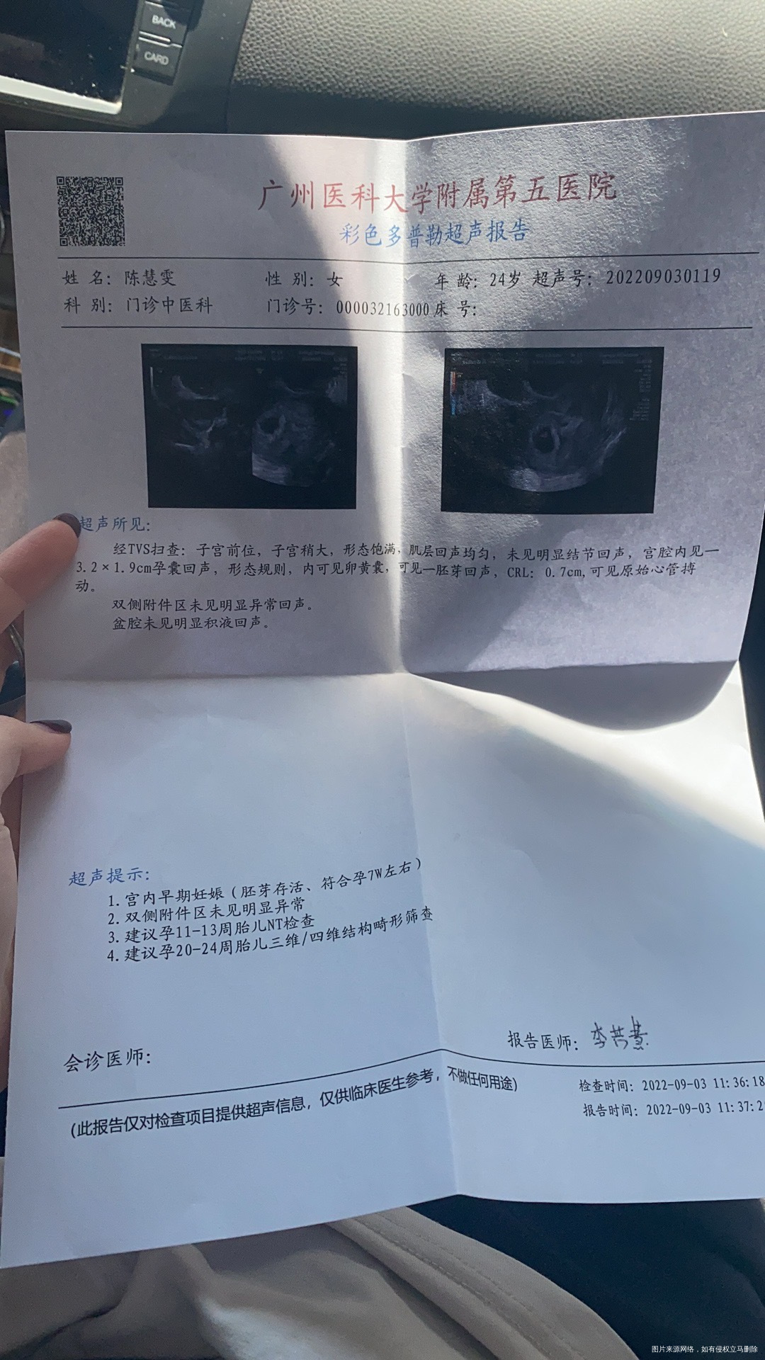 怀孕前有多囊这胎是自然怀孕3号孕7周18号差