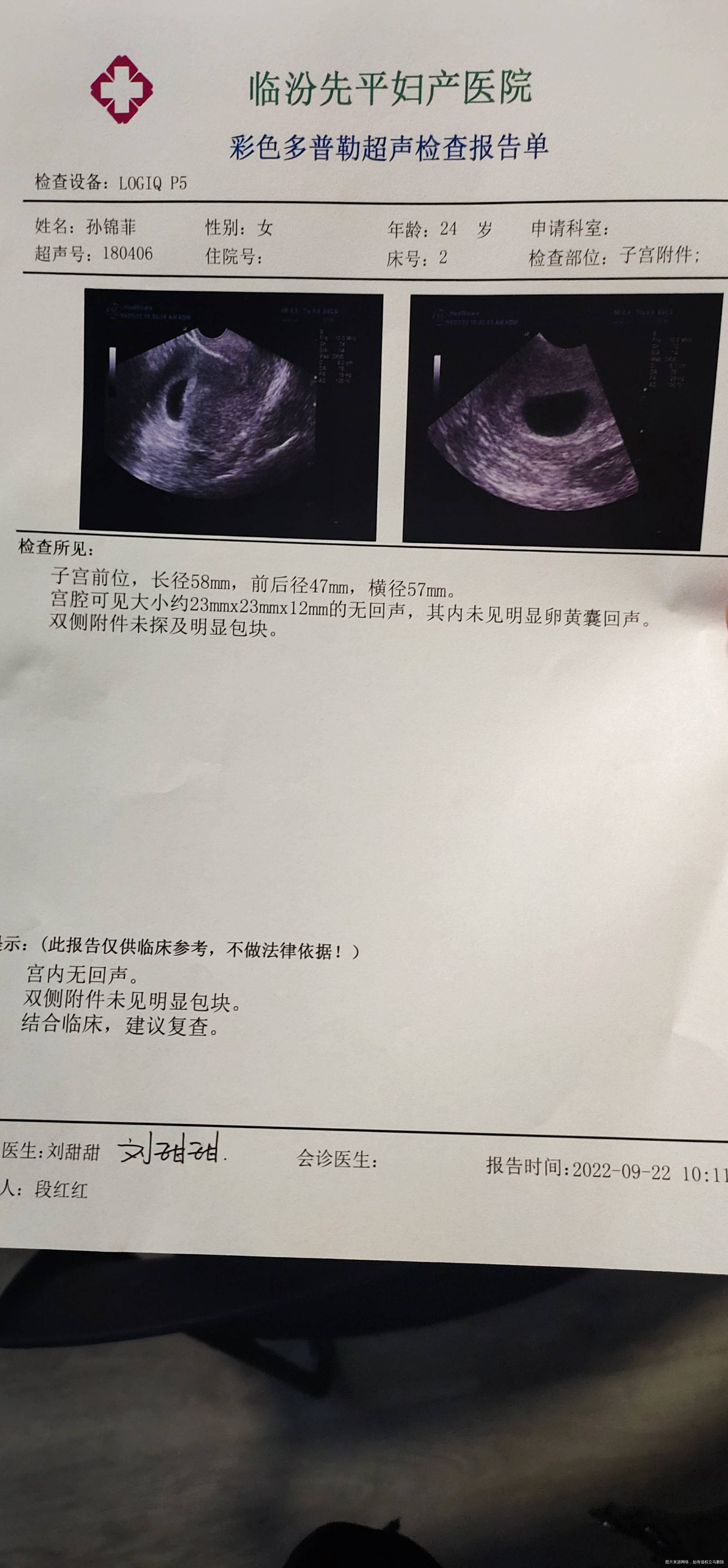 我末次月经81我还有等的必要嘛