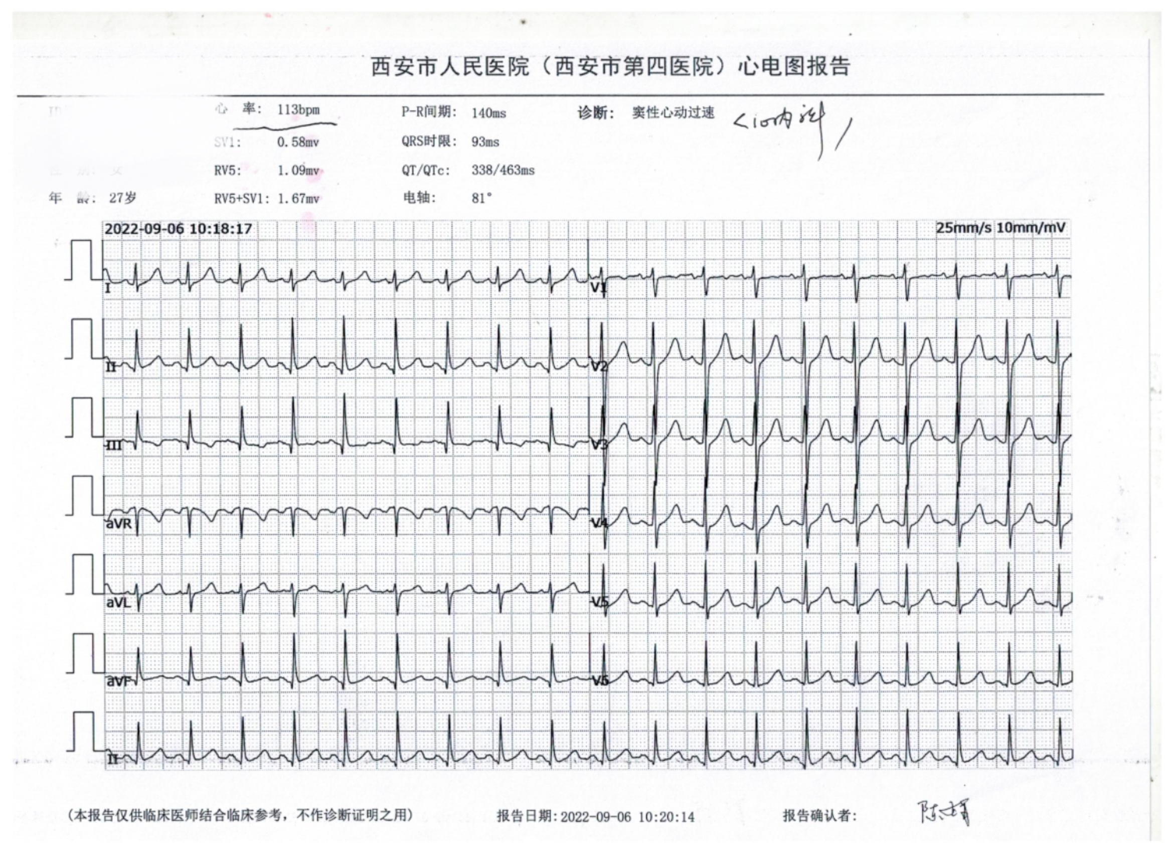 我今天是36周+4近期每天晚上睡前心跳加速易