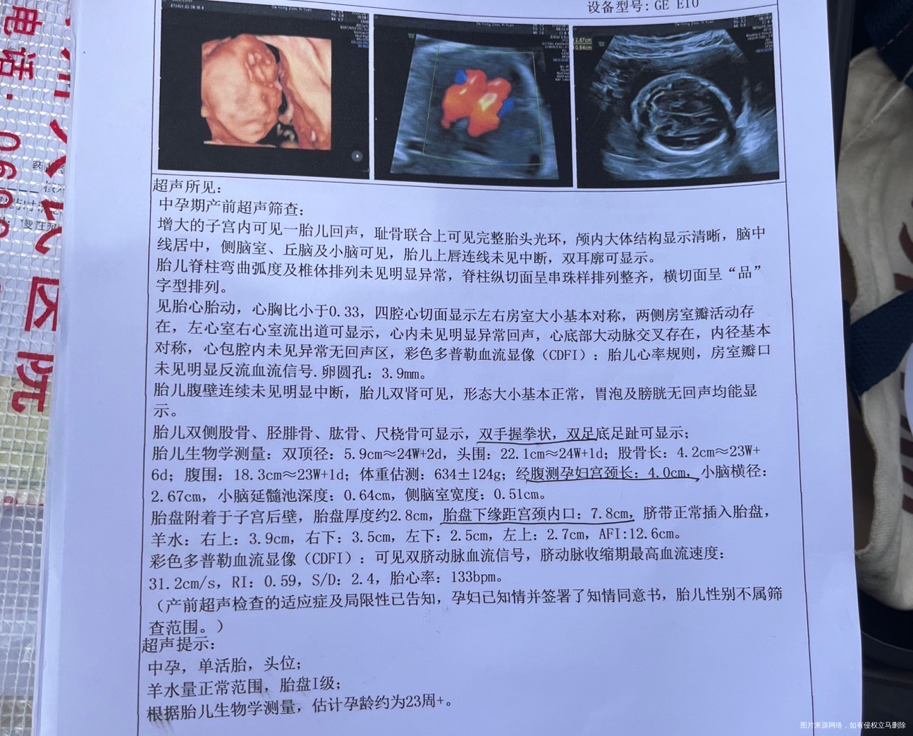 目前怀孕27周+总是爱流鼻涕打喷嚏可以吃什么
