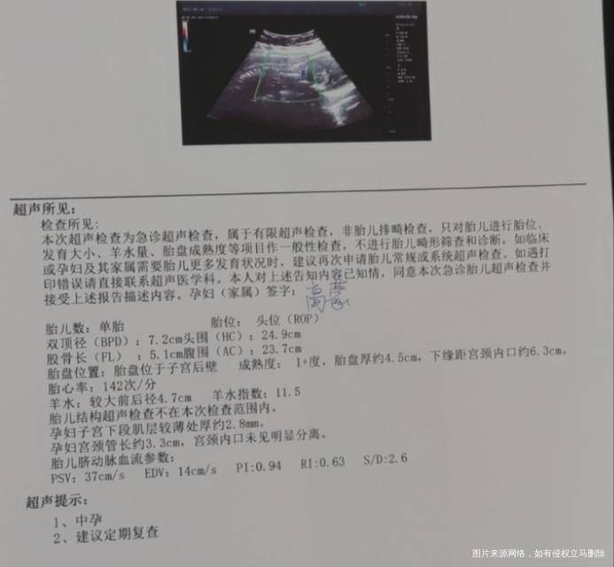 你好阴道有液体流出现在没有了做彩超羊水和昨天