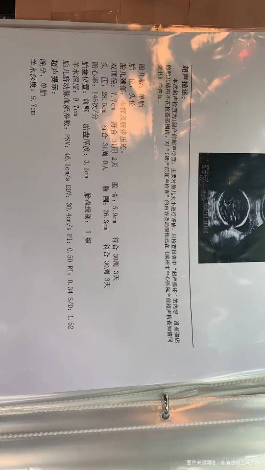 大夫我算着应该是28周+1今天做检查孩子大羊