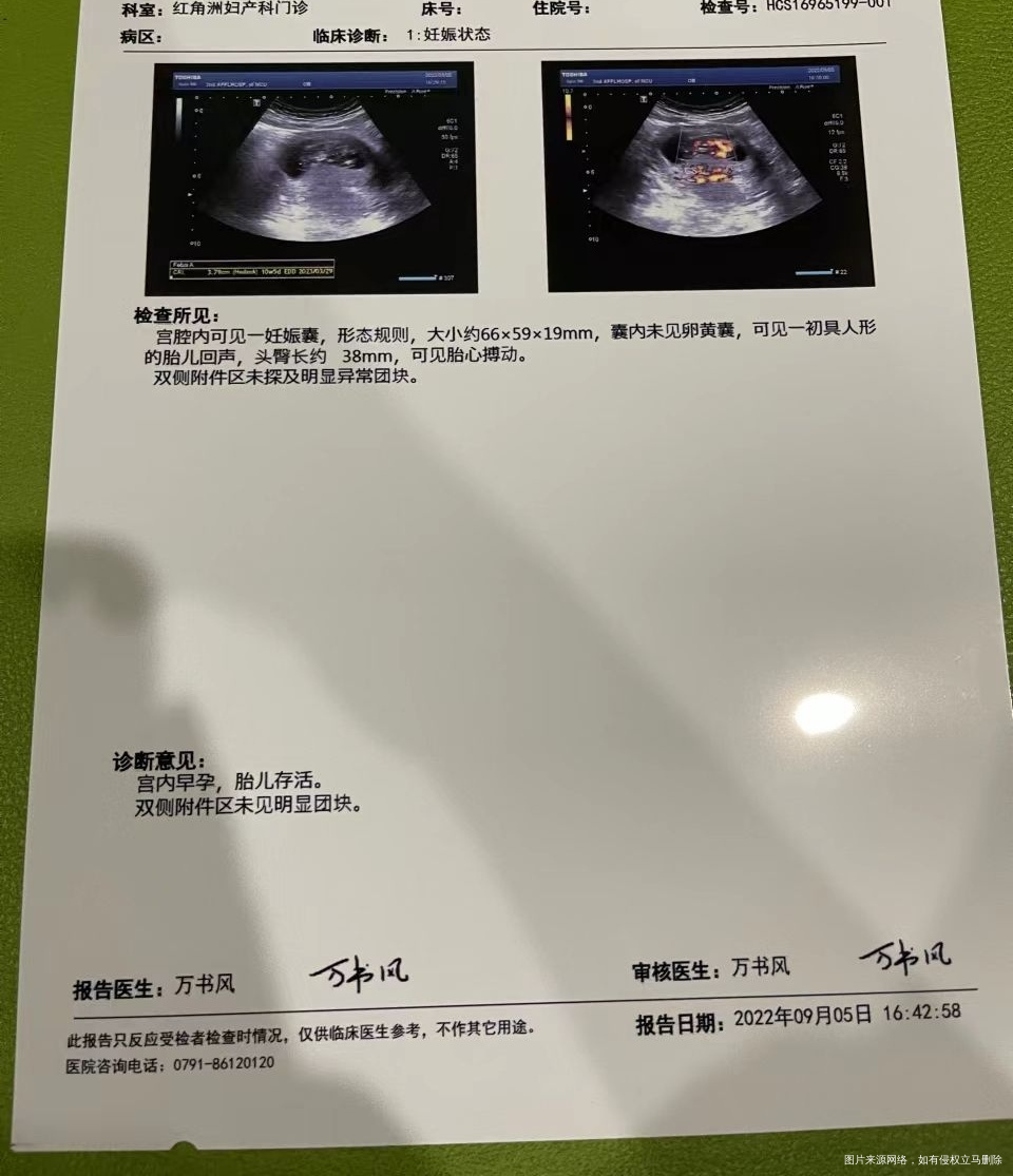 医生说10+6想问一下这个发育的怎么样啊