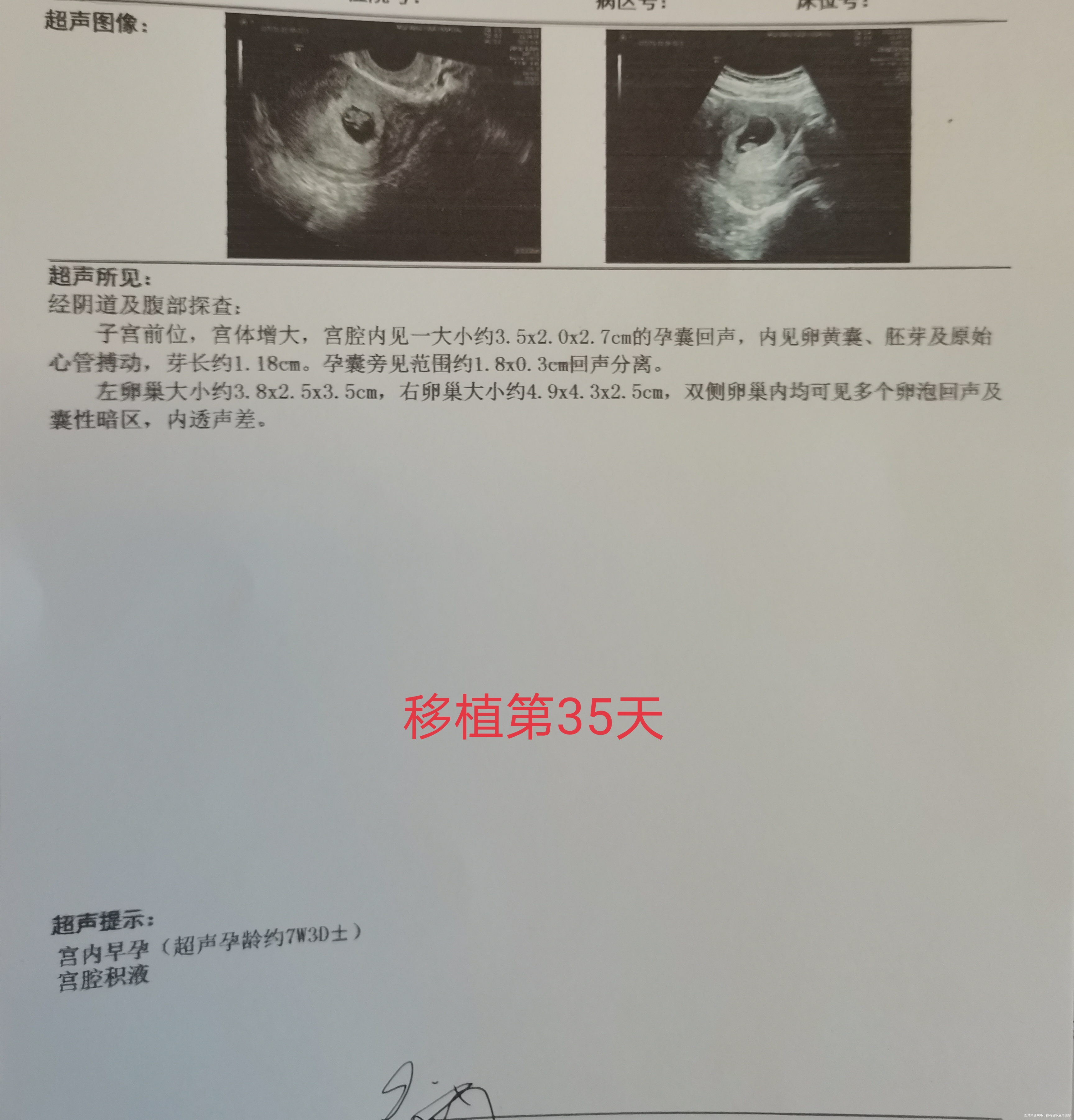 移植第35天做阴超时探头一进去医生说塞过药照