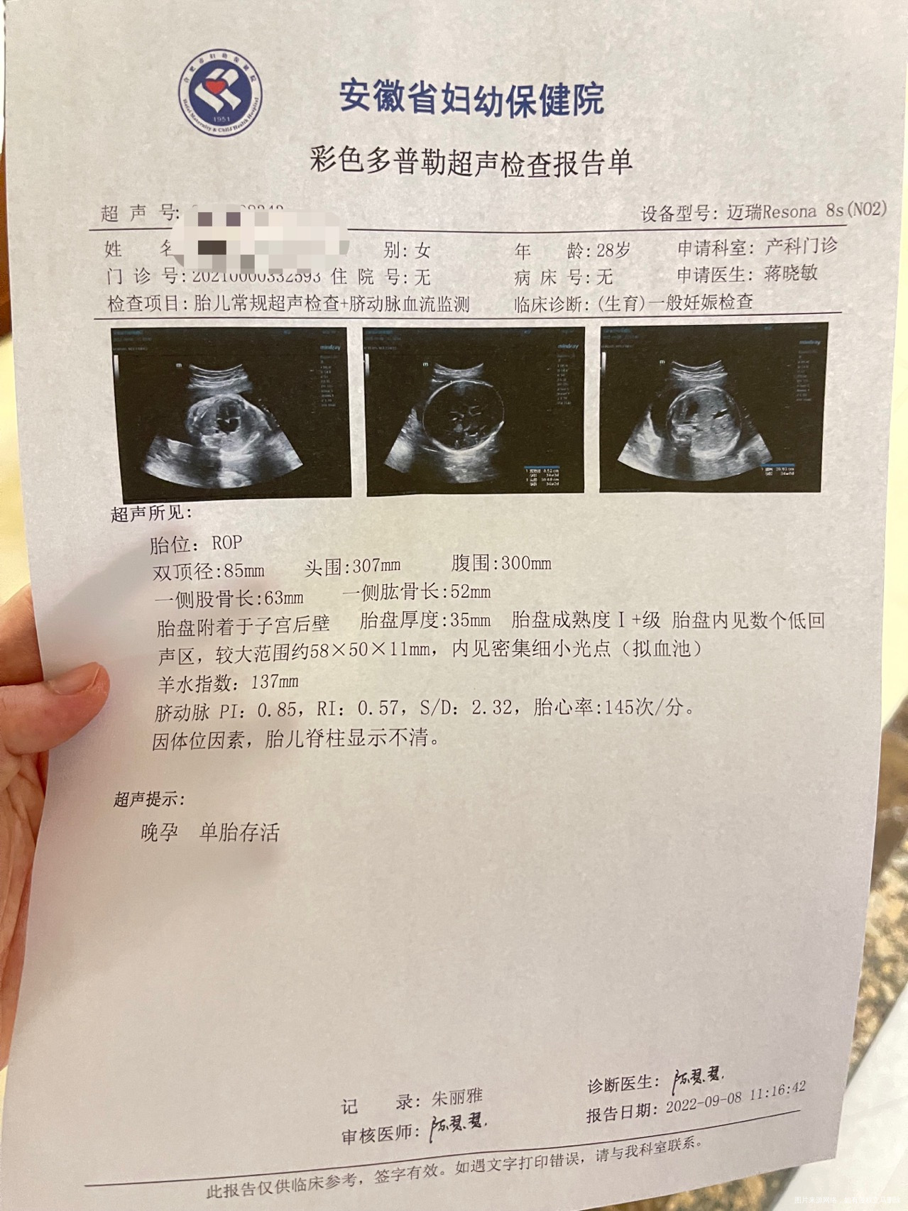 孕33➕6请问医生这个b超结果胎盘内回声有什