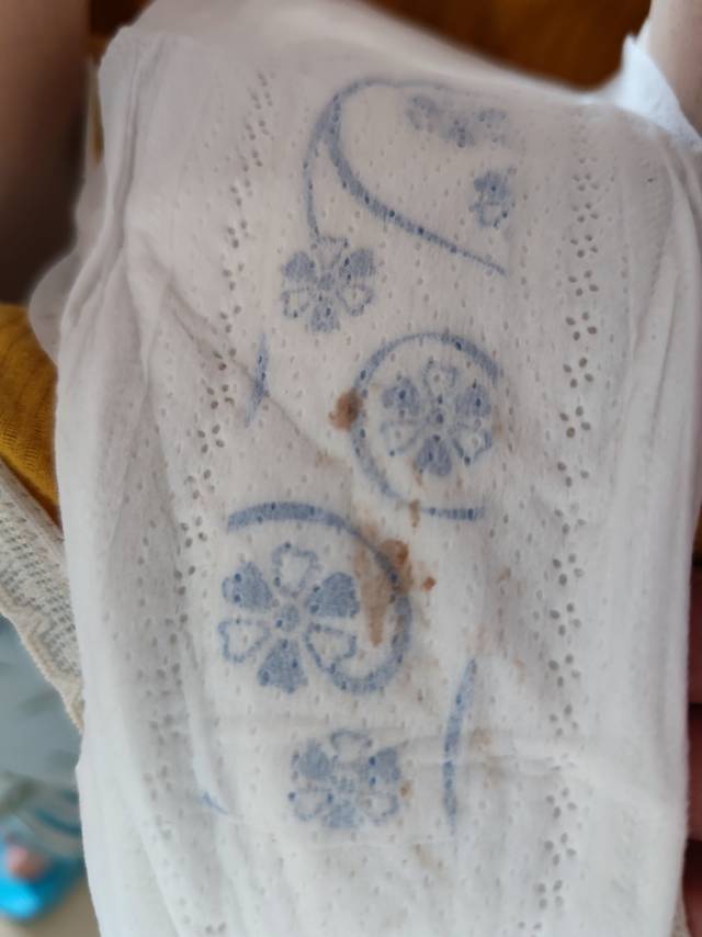 哺乳期持续5天多了分泌物这样怎么回事孩子快1