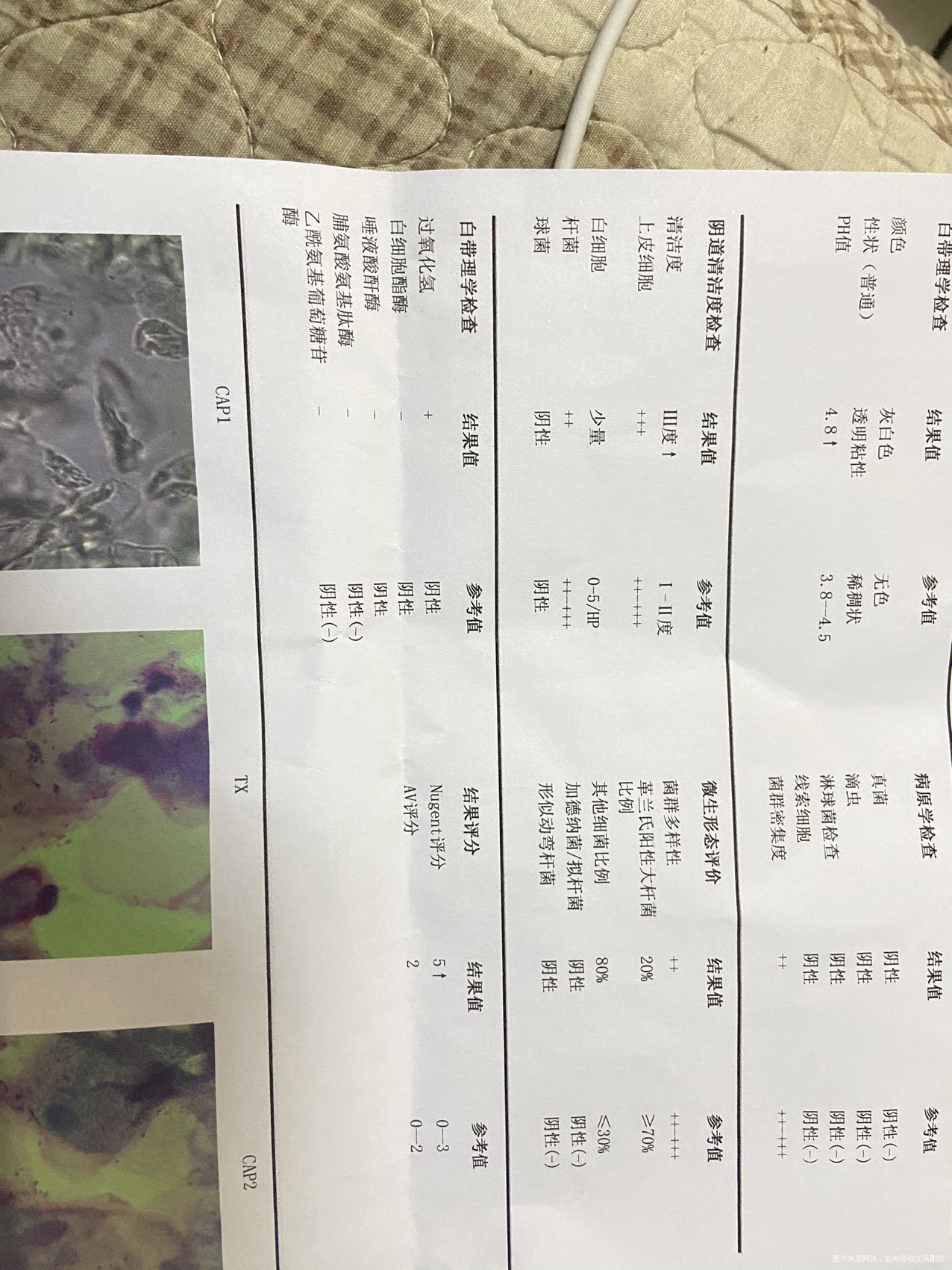 医生我这个是不是细菌性阴道炎啊下个月准备促排