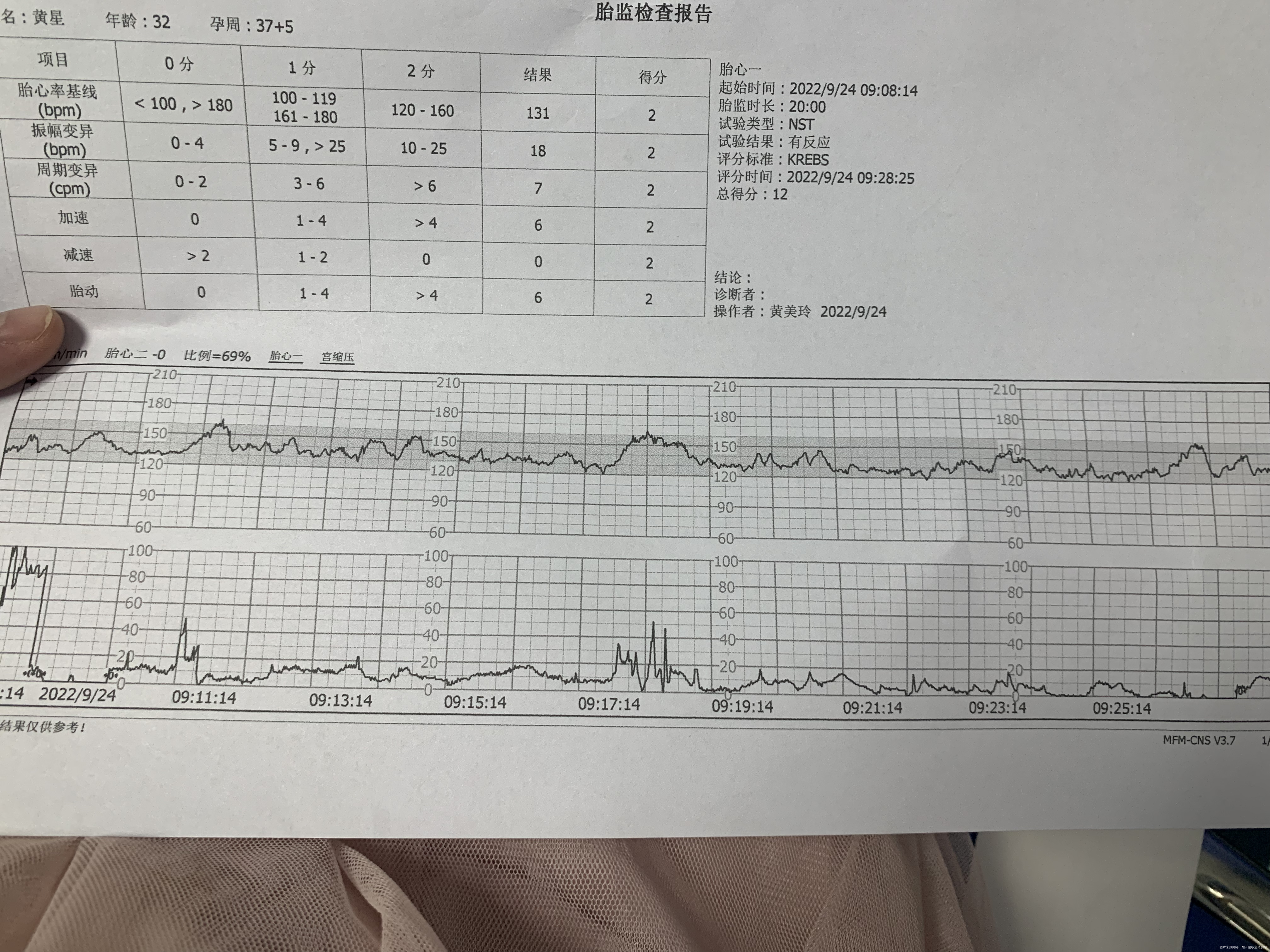 37+5的胎监结果麻烦医生看看有异常吗