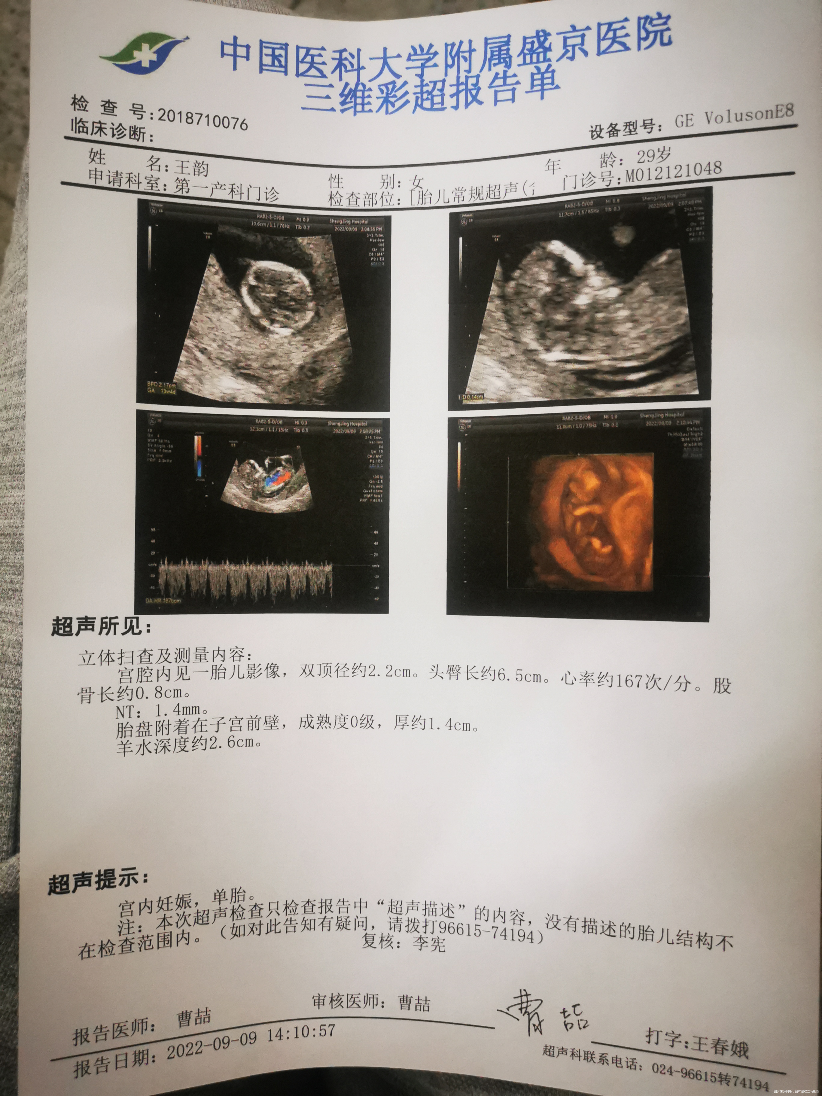 nt彩超12周+5麻烦看下除了nt值都正常吗