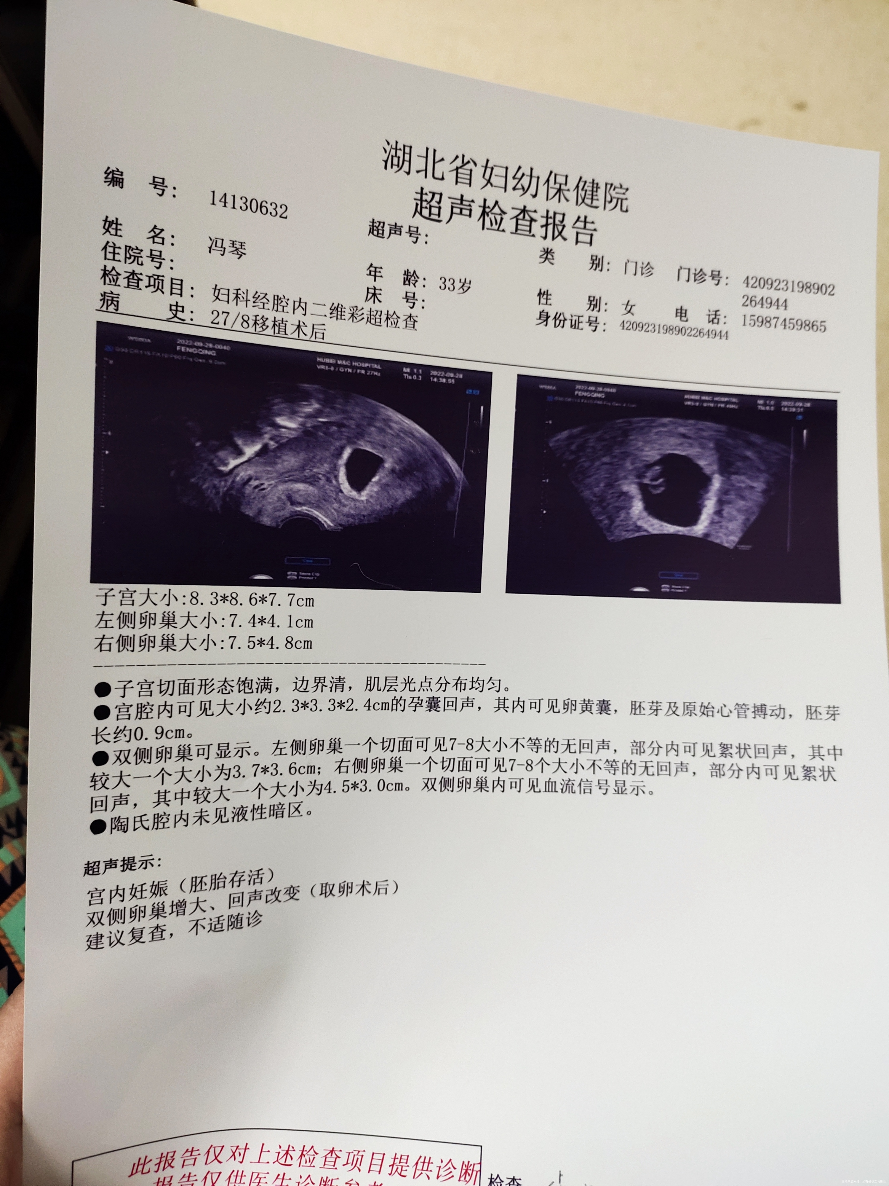 这是移植鲜囊胚后的第32天22号查一超胎心隐