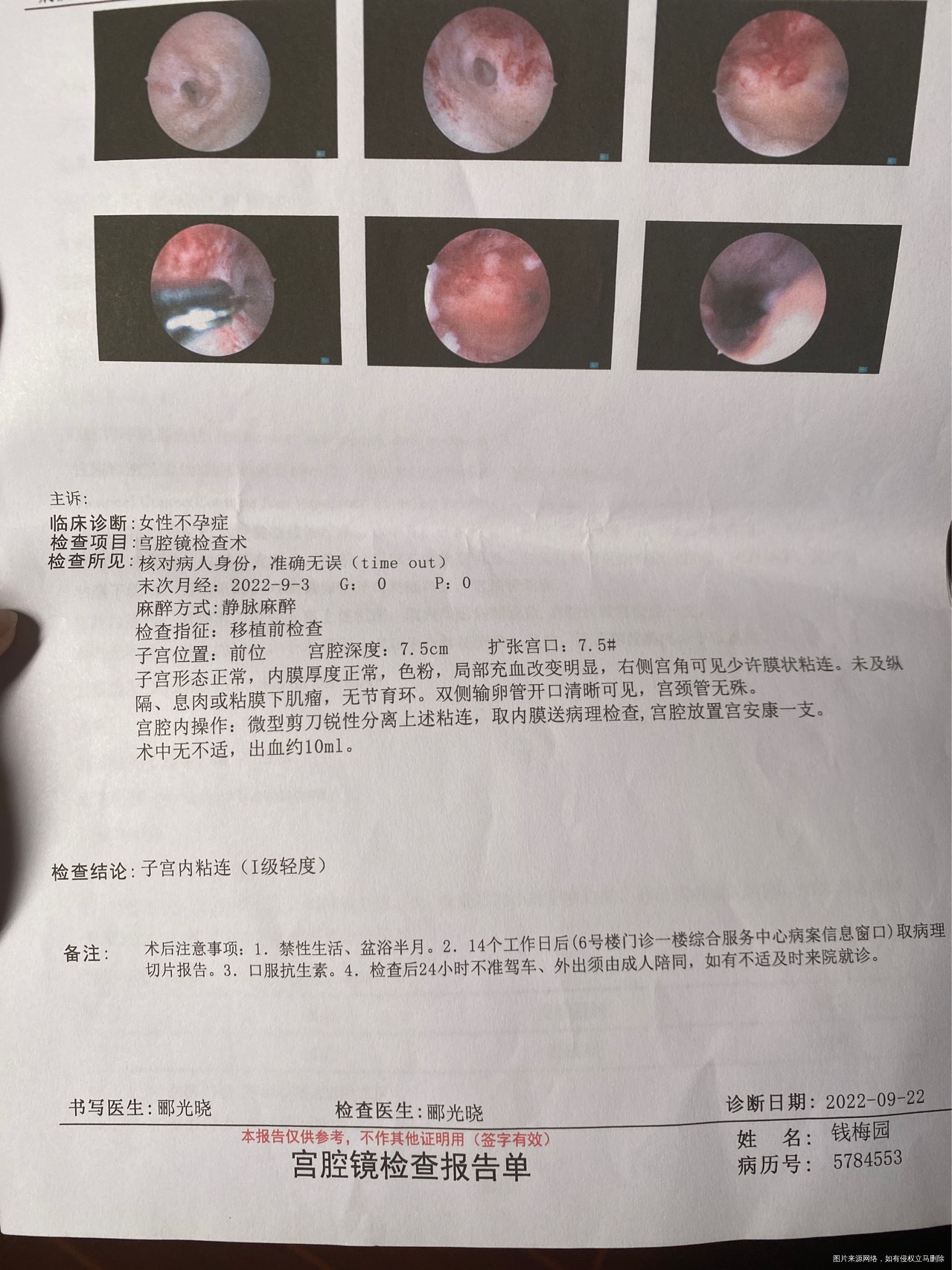 宫腔镜做完出血量有点多还有大小不一的血块正常