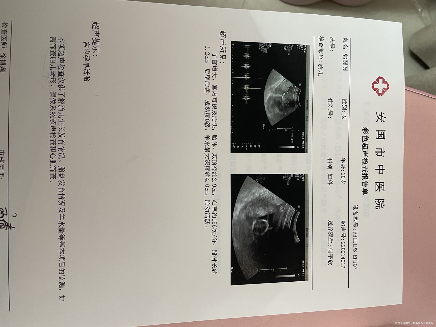 怀孕三个多同房流血去医院检查彩超医生说没有问