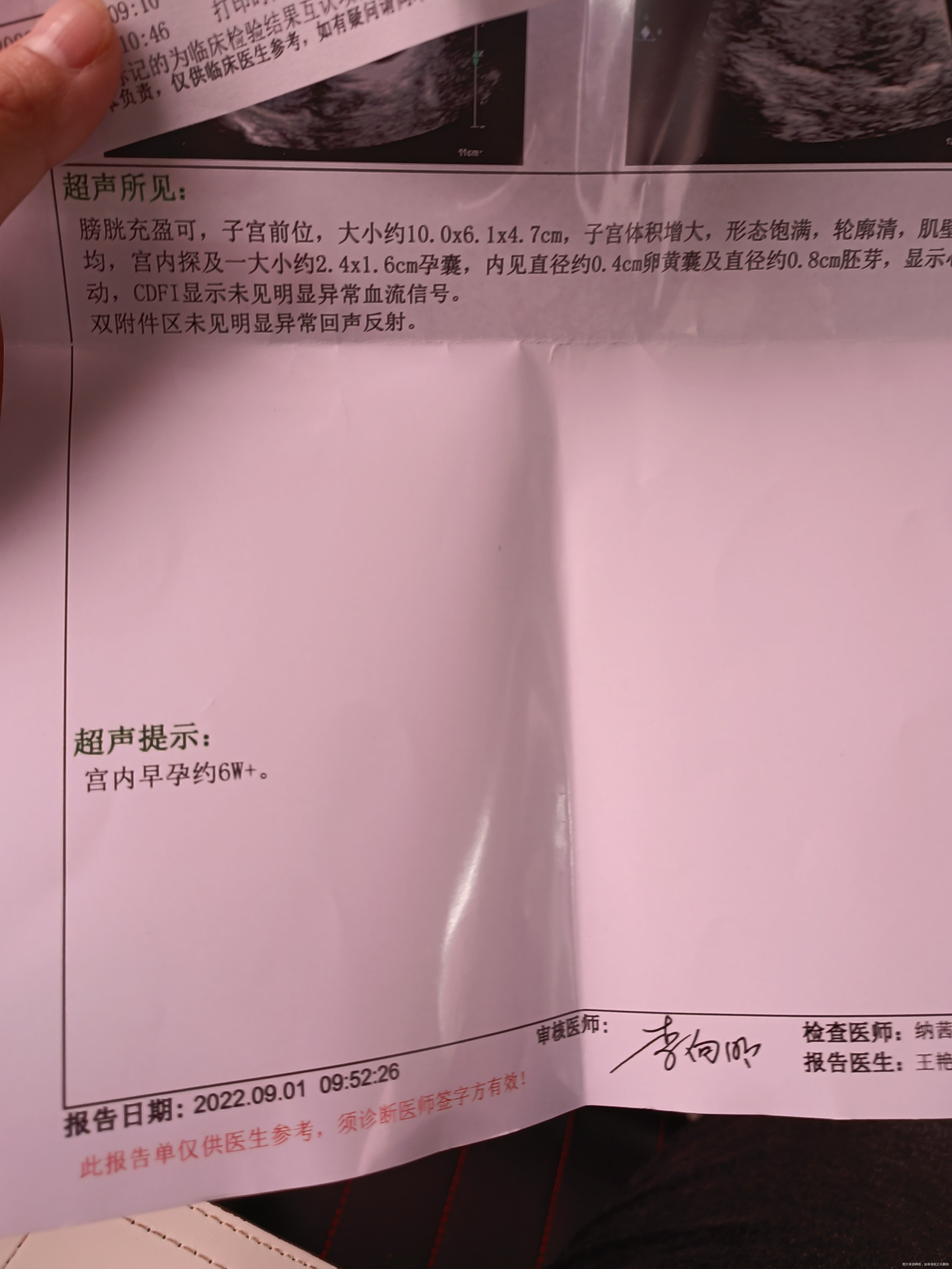 末次月经7月8日今天检查医生说孕酮有点低开了