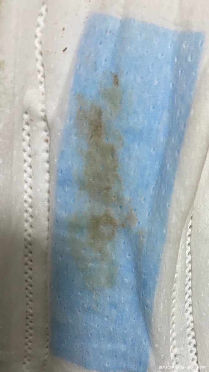 昨天刚做完宫腔镜今天流这种分泌物正常吗