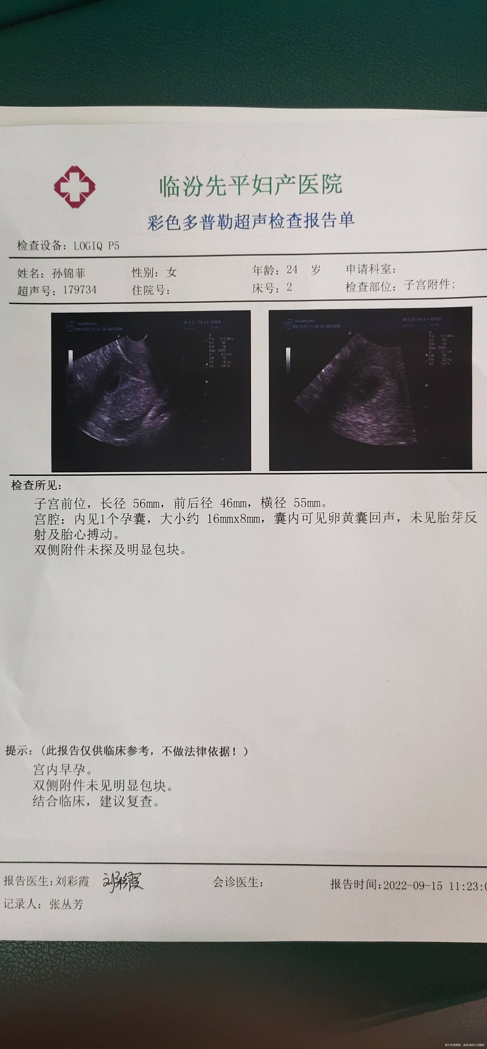 我末次月经81我还有等的必要嘛
