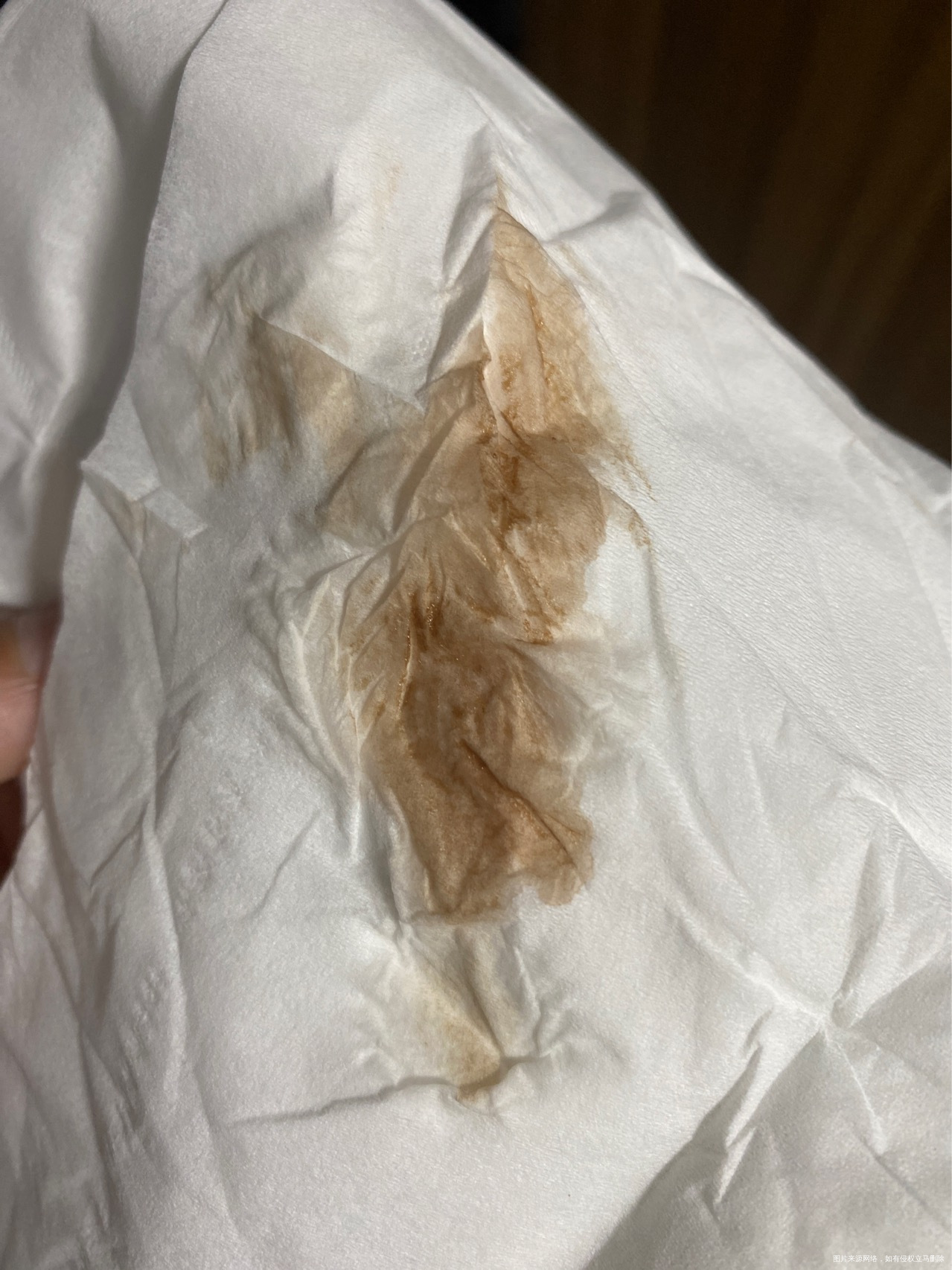 宫腔镜做完四五天逛街下面就流这种分泌物不多正