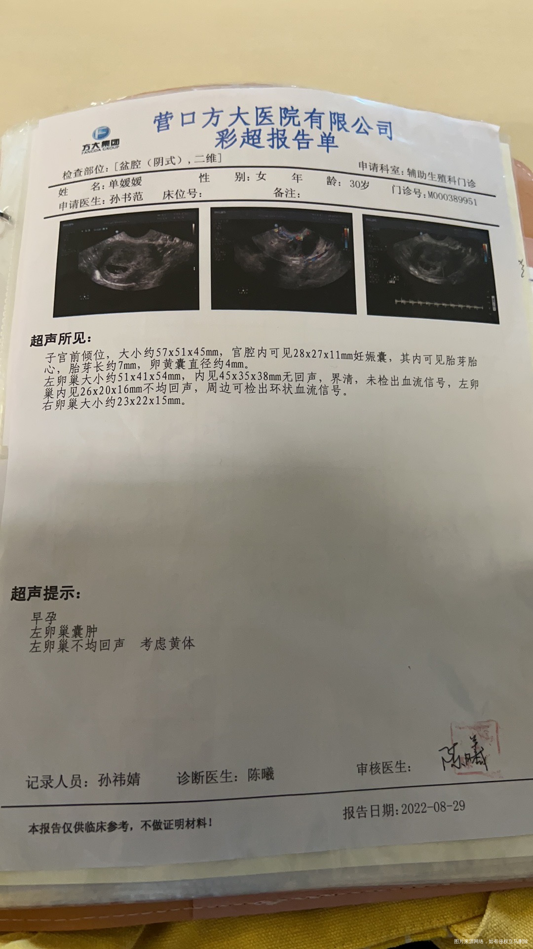 差各项都很好但是我左侧小腹今天疼的比较多一阵