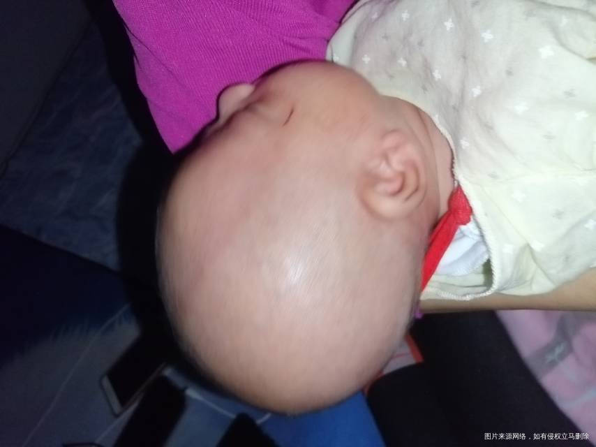 孩子额头那有一道很明显的弧沟这是咋回事睡一觉