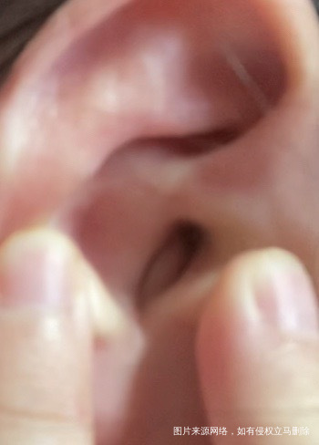 孕20周之前洗澡耳朵进水最近疼而且起了个疙瘩