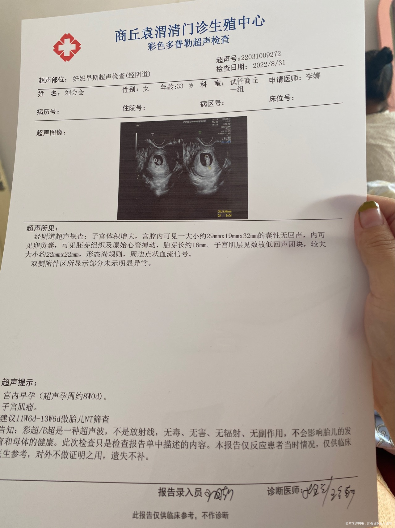 723号移植的今天第40天医生说孕囊小容易胎