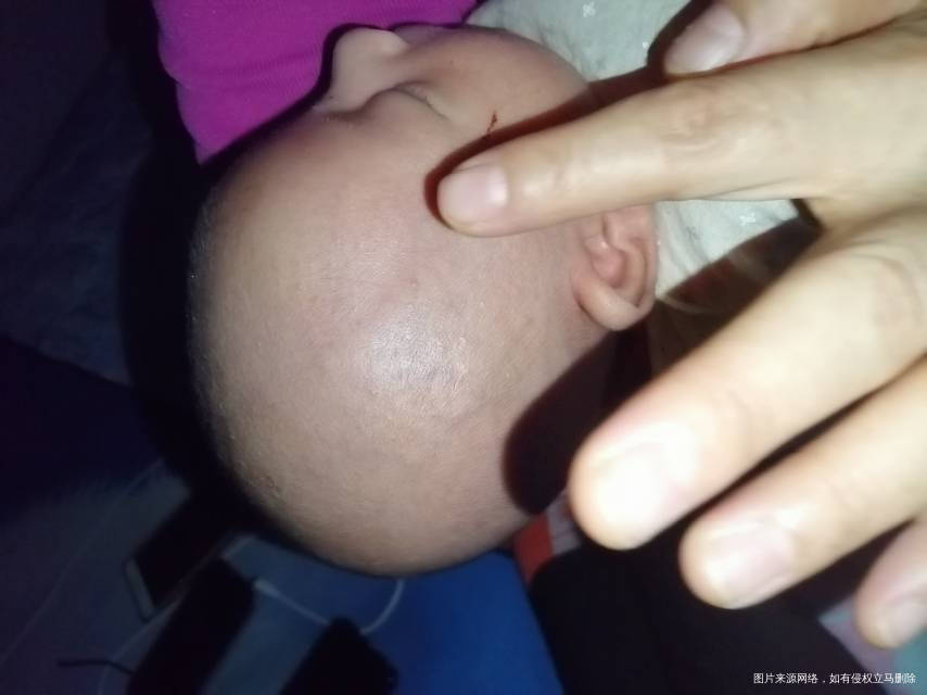 孩子额头那有一道很明显的弧沟这是咋回事睡一觉